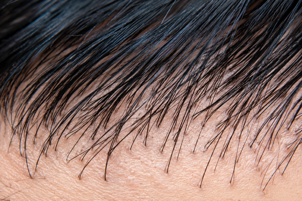 Close-up of healthy scalp and hair follicles